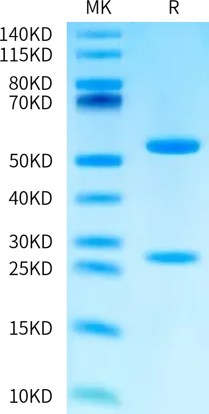Real Bis-Tris PAGE quality-control data for PROVETOP anti-VEGFR2 antibody VEGFR2-AB001