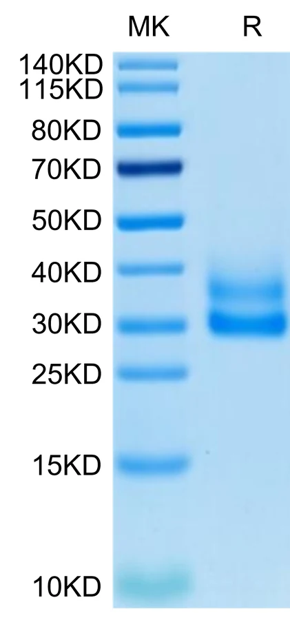 41BB-CP001 Bis-Tris-PAGE-white result