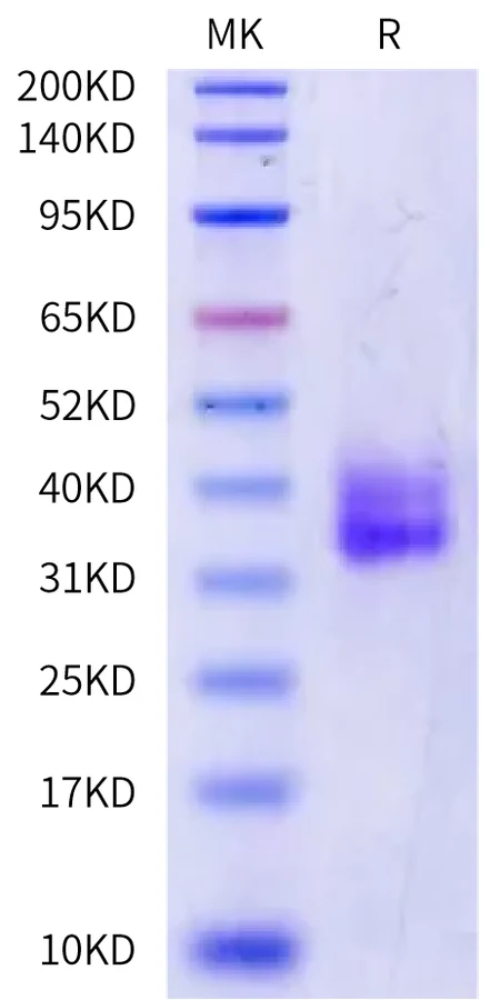 41BB-HB005 Bis-Tris-PAGE-white result