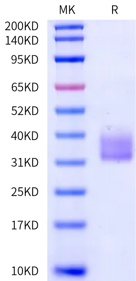 41BB-HP001 Bis-Tris-PAGE-white result