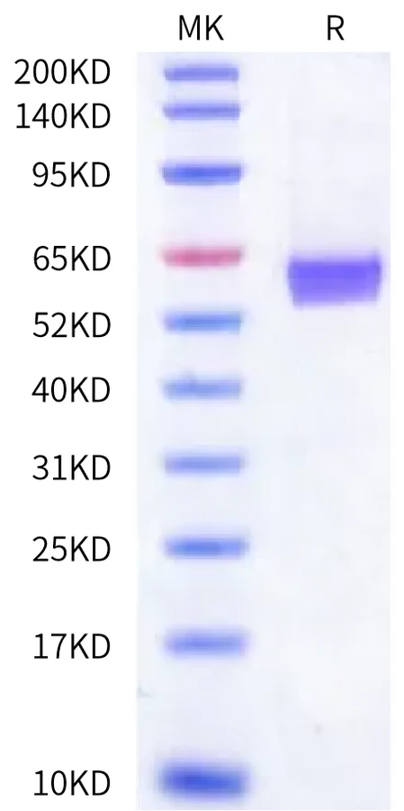 41BB-HP004 Bis-Tris-PAGE-white result