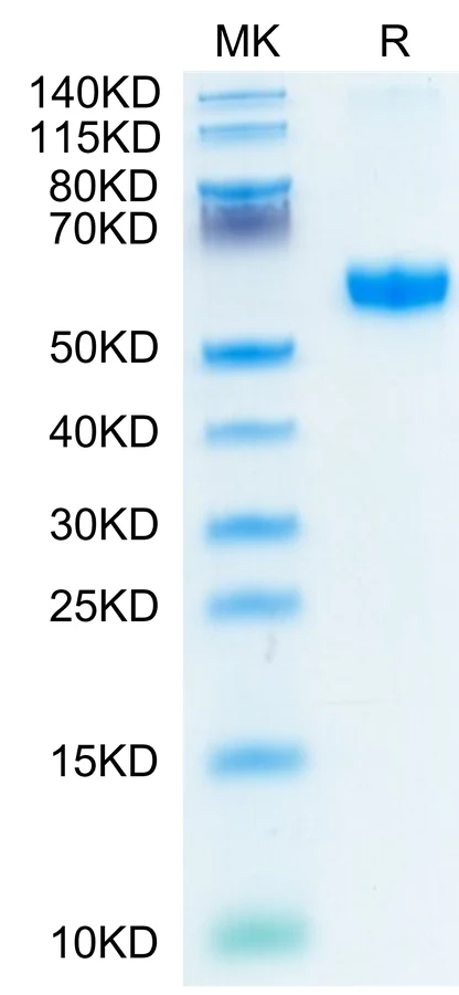 41BB-HP005 Bis-Tris-PAGE-white result