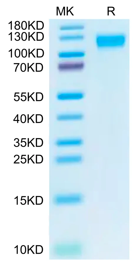 ACE2-CB001 Bis-Tris-PAGE-white result