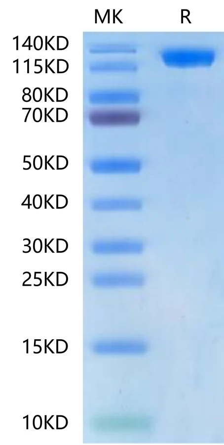 ACE2-HB002 Bis-Tris-PAGE-white result