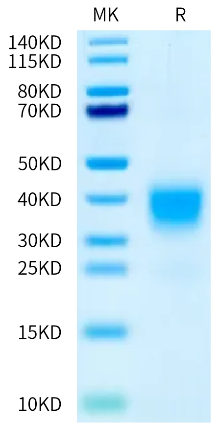 ACTIVINRIIA-HB003 Bis-Tris-PAGE-white result