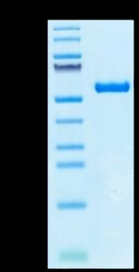 AFP-HB001 Bis-Tris-PAGE result