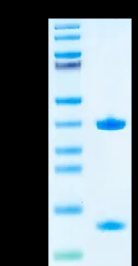 AFP-HP001 Bis-Tris-PAGE result