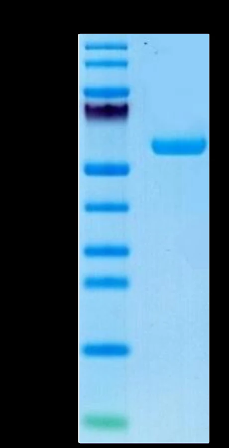 AFP-HP002 Bis-Tris-PAGE result