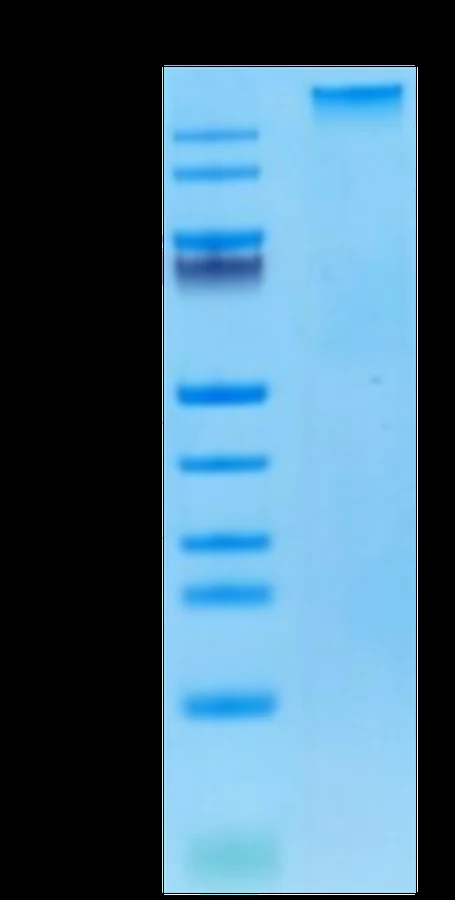 AFP-HP003 Bis-Tris-PAGE result