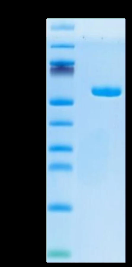 AFP-HP005 Bis-Tris-PAGE result