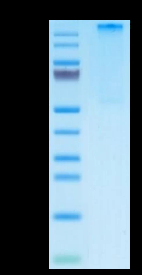 AFP-HP006 Bis-Tris-PAGE result