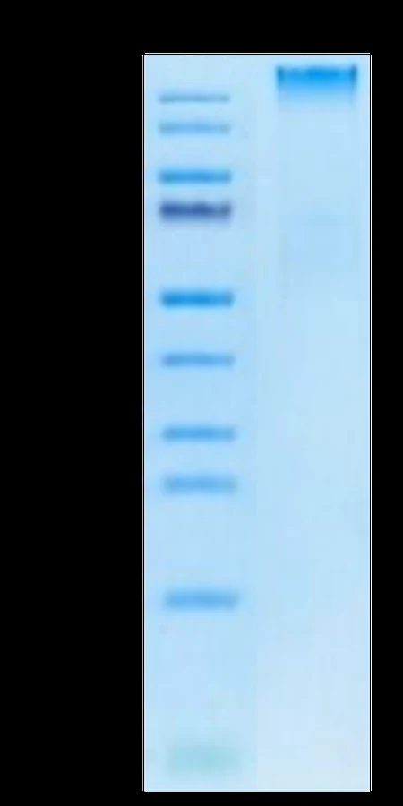 AFP-HP009 Bis-Tris-PAGE result