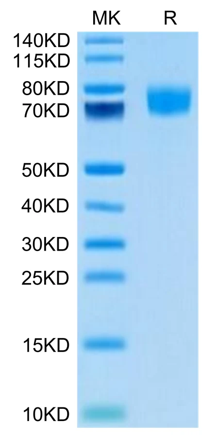 ALCAM-HB001 Bis-Tris-PAGE-white result