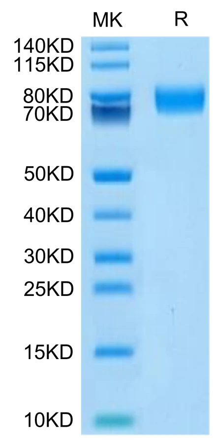 ALCAM-HB002 Bis-Tris-PAGE-white result