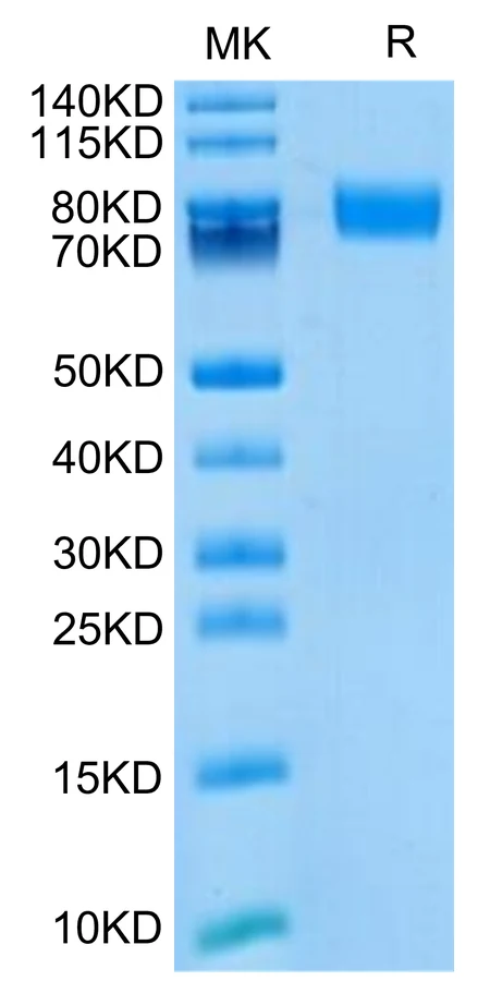 ALCAM-MB001 Bis-Tris-PAGE-white result