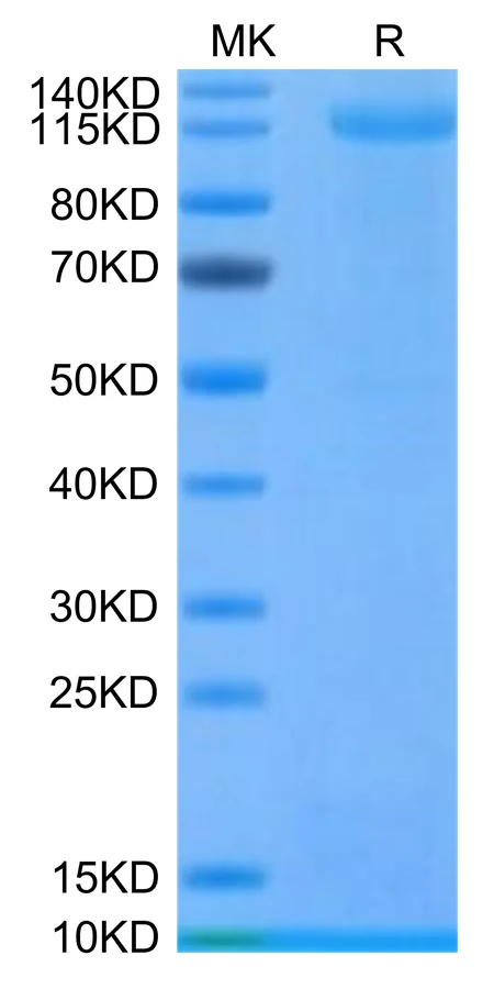 ALK-MF001 Bis-Tris-PAGE-white result