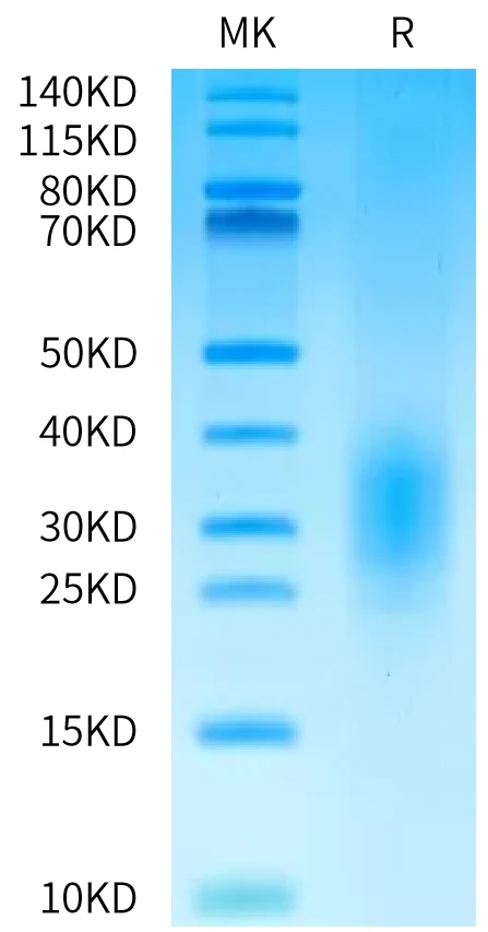 ALK7-HB001 Bis-Tris-PAGE-white result