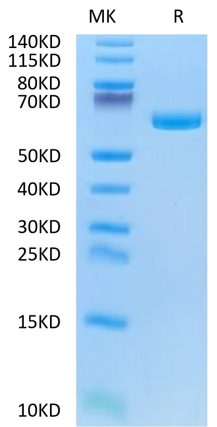 ALPG-HB001 Bis-Tris-PAGE-white result