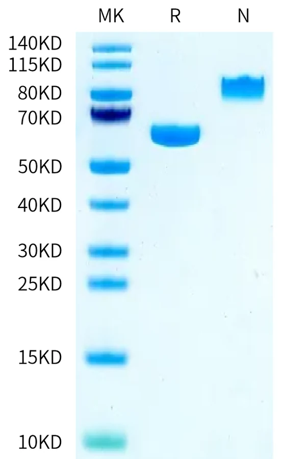 ALPP-CB001 Bis-Tris-PAGE-white result