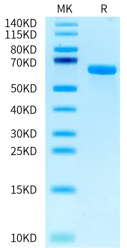 ALPP-HB001 Bis-Tris-PAGE-white result