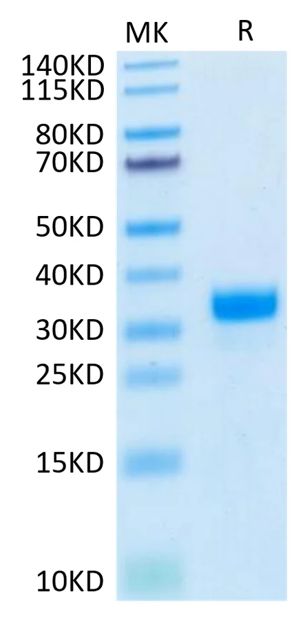 ANGPT2-HB001 Bis-Tris-PAGE-white result