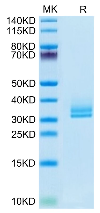 ANGPTL2-HB001 Bis-Tris-PAGE-white result