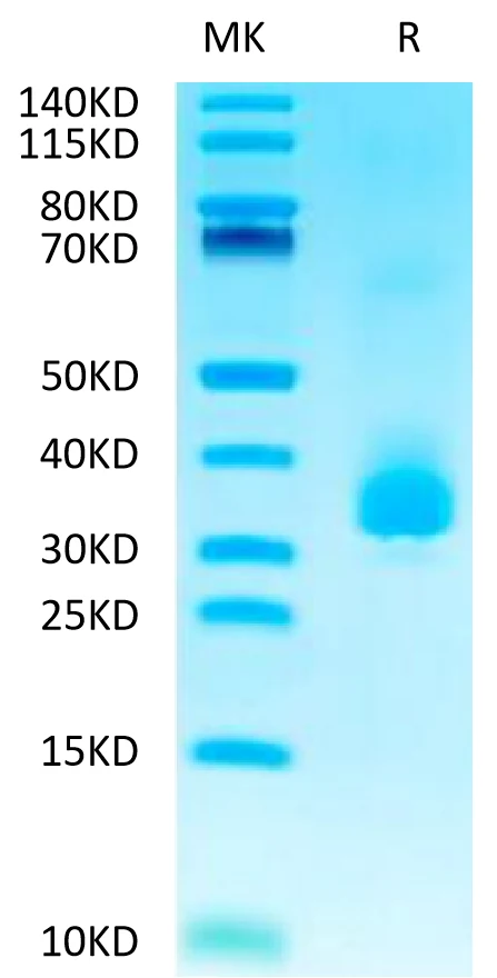 ANGPTL3-HB001 Bis-Tris-PAGE-white result