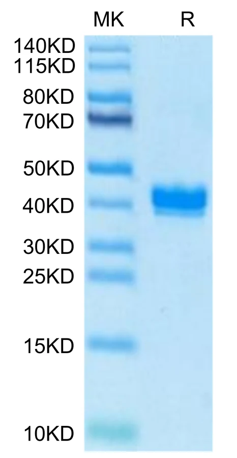 APLN-MB001 Bis-Tris-PAGE-white result