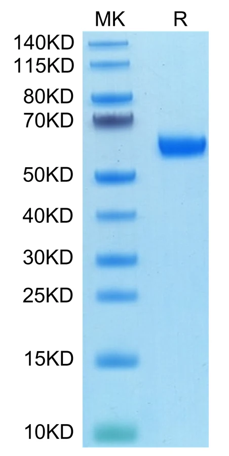 APRIL-CB001 Bis-Tris-PAGE-white result