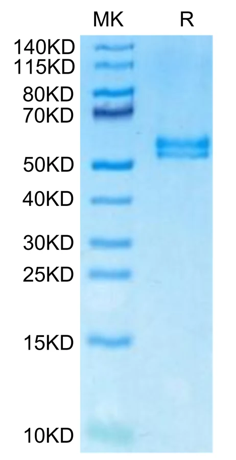 APRIL-MF001 Bis-Tris-PAGE-white result
