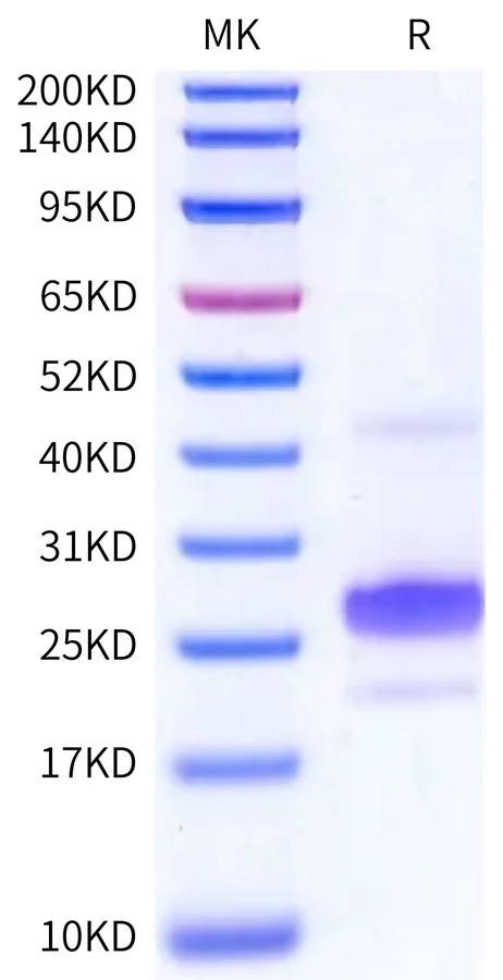 APRIL-MP001 Bis-Tris-PAGE-white result