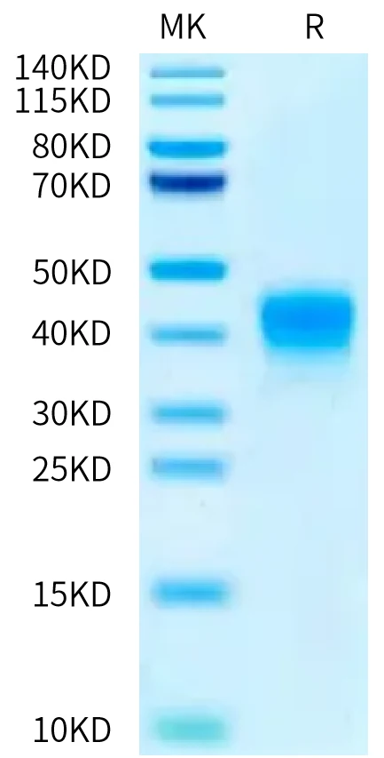 ASGR1-HB001 Bis-Tris-PAGE-white result