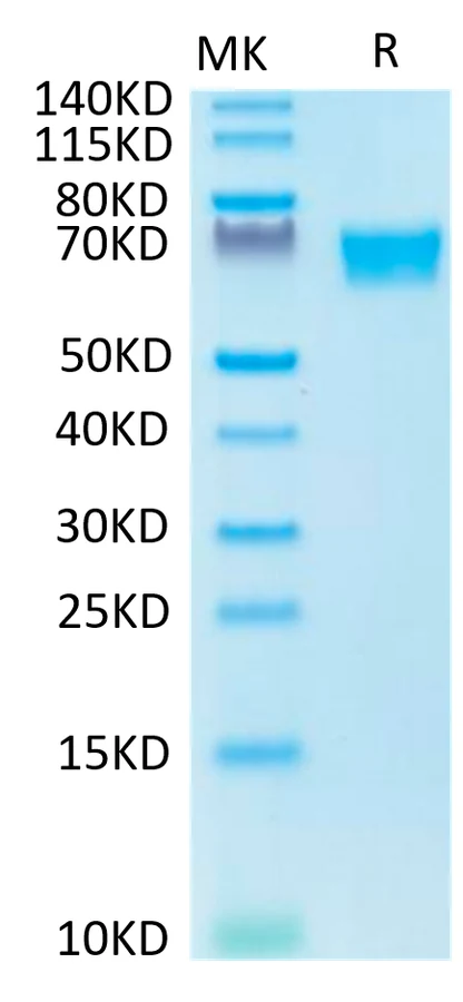 AXL-HB002 Bis-Tris-PAGE-white result