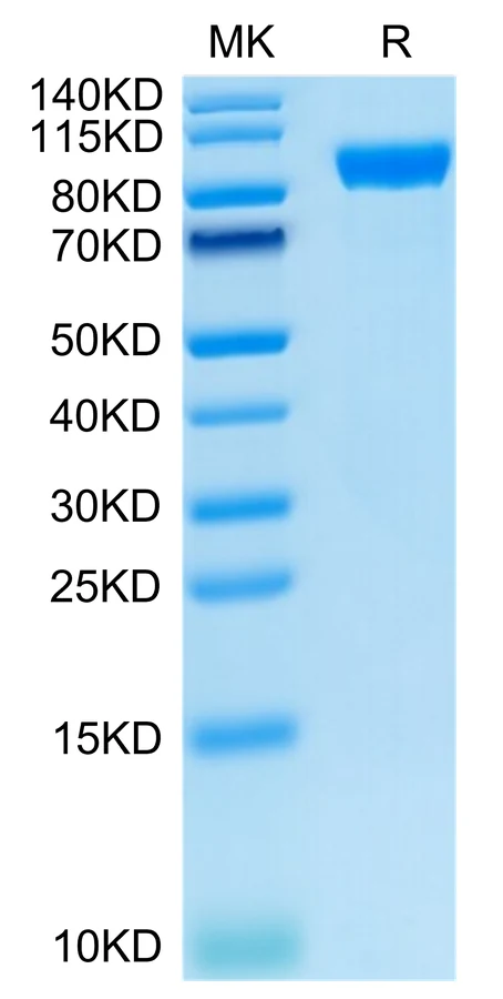 AXL-HF001 Bis-Tris-PAGE-white result
