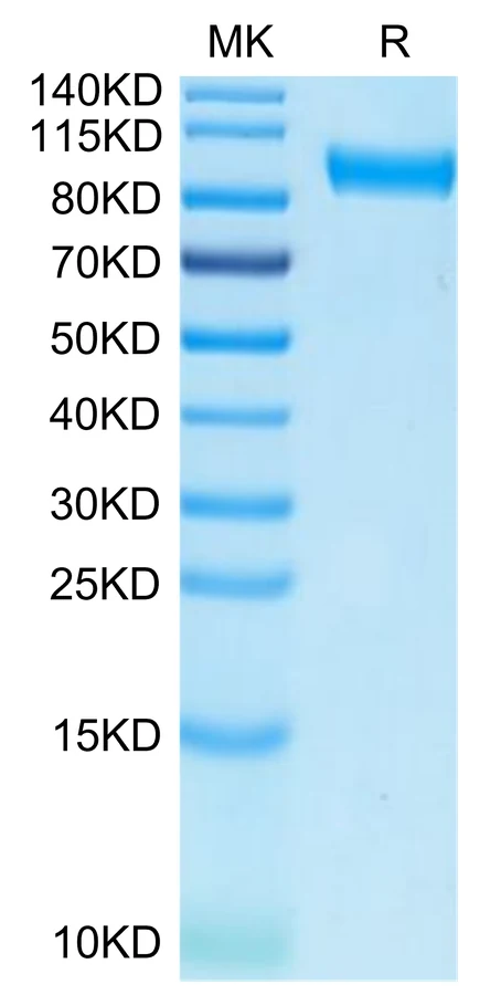 AXL-HF002 Bis-Tris-PAGE-white result