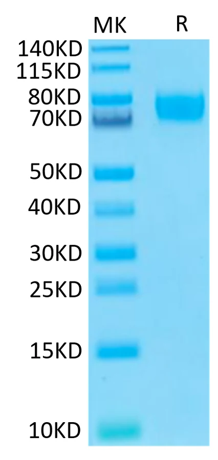 B7H3-HB001 Bis-Tris-PAGE-white result