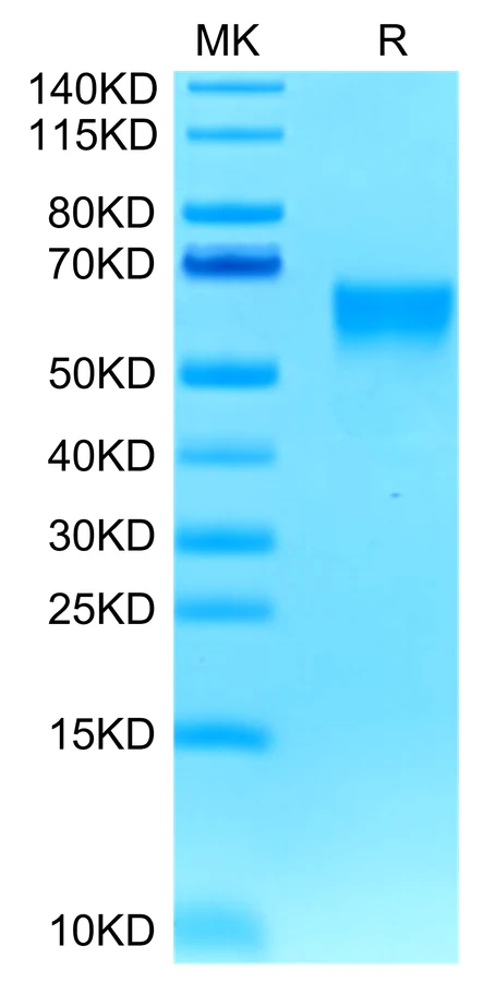 B7H4-HB003 Bis-Tris-PAGE-white result