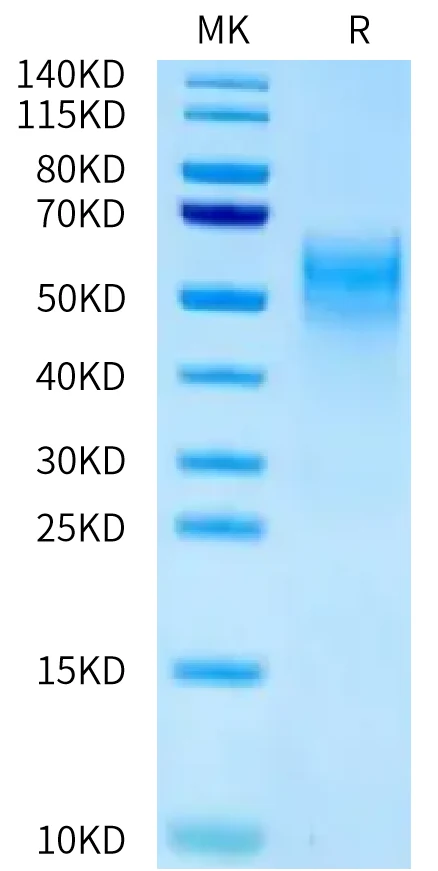 B7H4-MP001 Bis-Tris-PAGE-white result