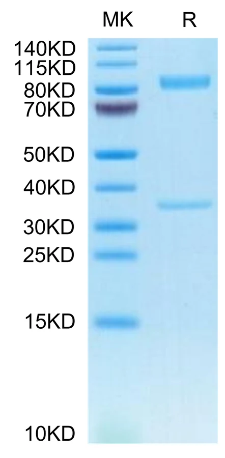 BACE1-HF001 Bis-Tris-PAGE-white result