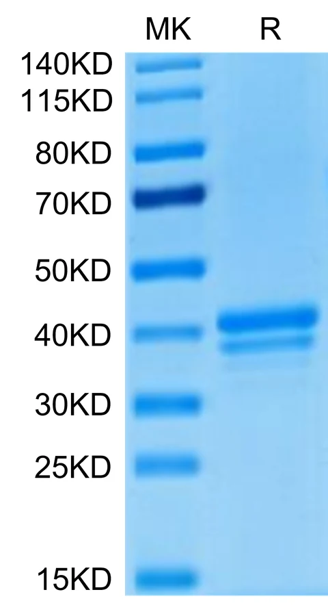 BCMA-HF001 Bis-Tris-PAGE-white result