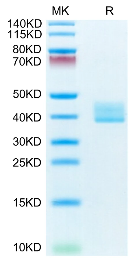 BCMA-MF001 Bis-Tris-PAGE-white result