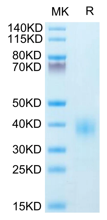 BTLA-HB001 Bis-Tris-PAGE result