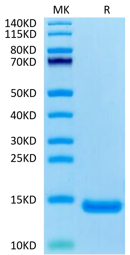 CCL11-HP001 Bis-Tris-PAGE-white result