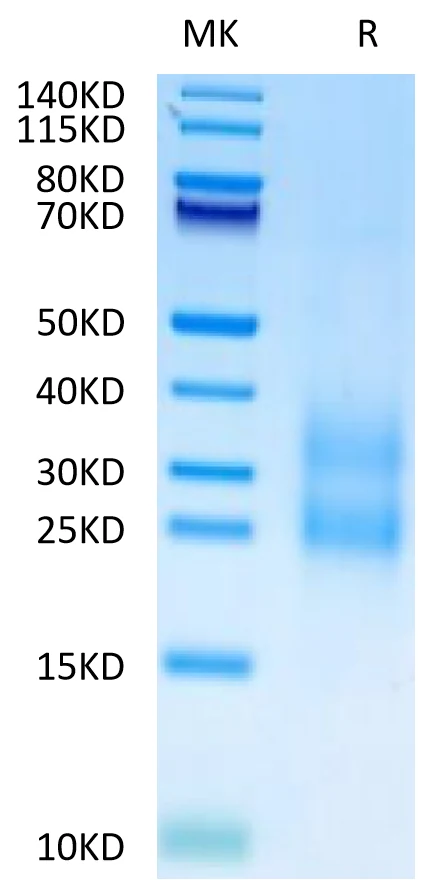 CCL24-CP001 Bis-Tris-PAGE-white result