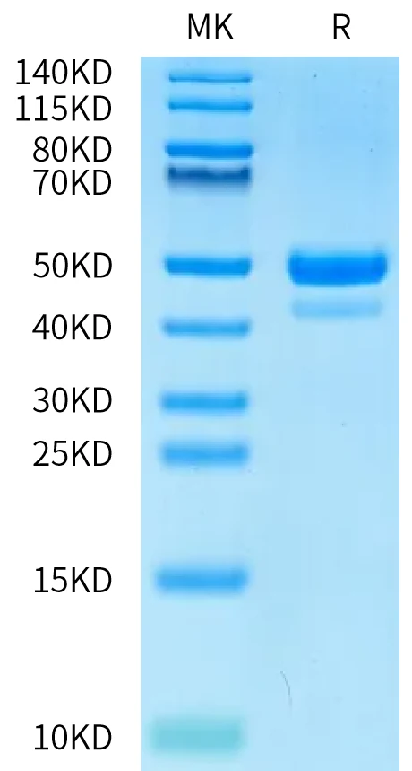 CCL24-HF001 Bis-Tris-PAGE-white result