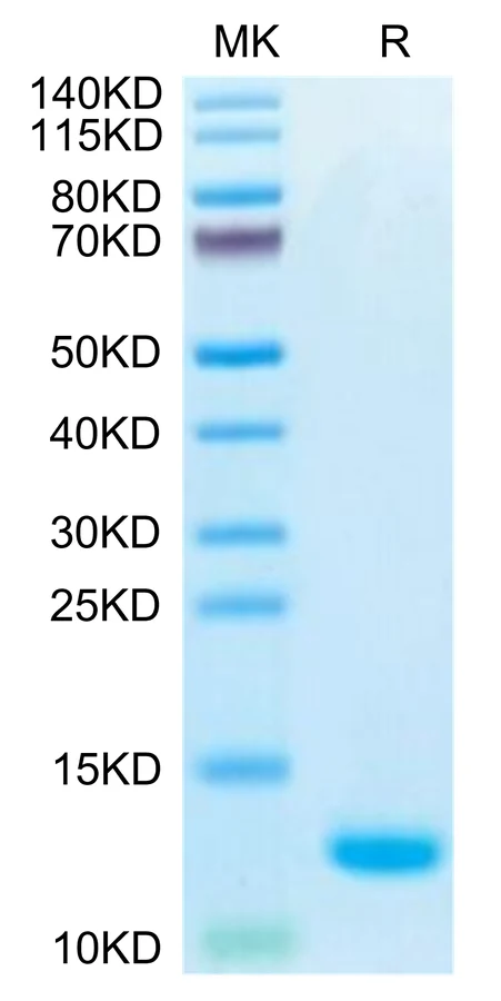 CCL5-HB001 Bis-Tris-PAGE-white result