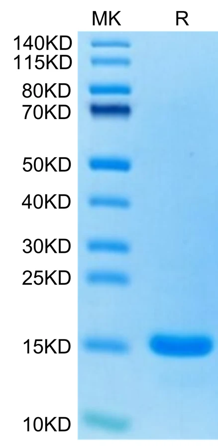 CCL7-HP001 Bis-Tris-PAGE-white result
