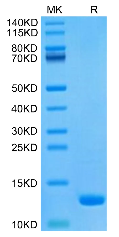CCL8-HP001 Bis-Tris-PAGE-white result