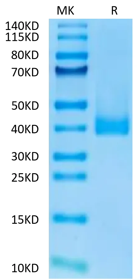 CCR8-CF001 Bis-Tris-PAGE-white result