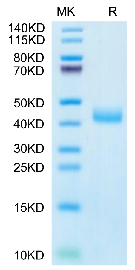 CCR8-HF001 Bis-Tris-PAGE-white result